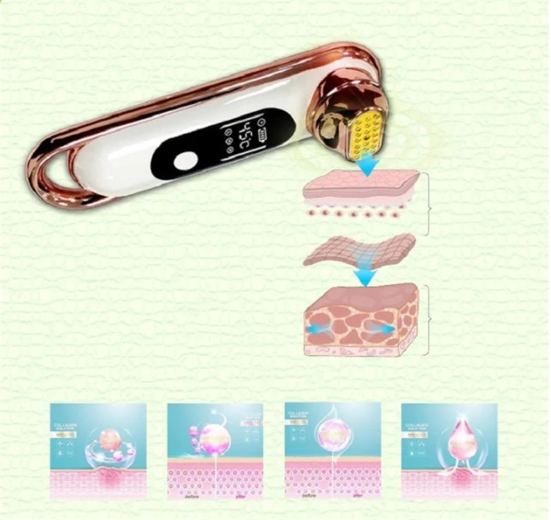 24K RF Beauty Device for Firming, Whitening, and Skin Rejuvenation