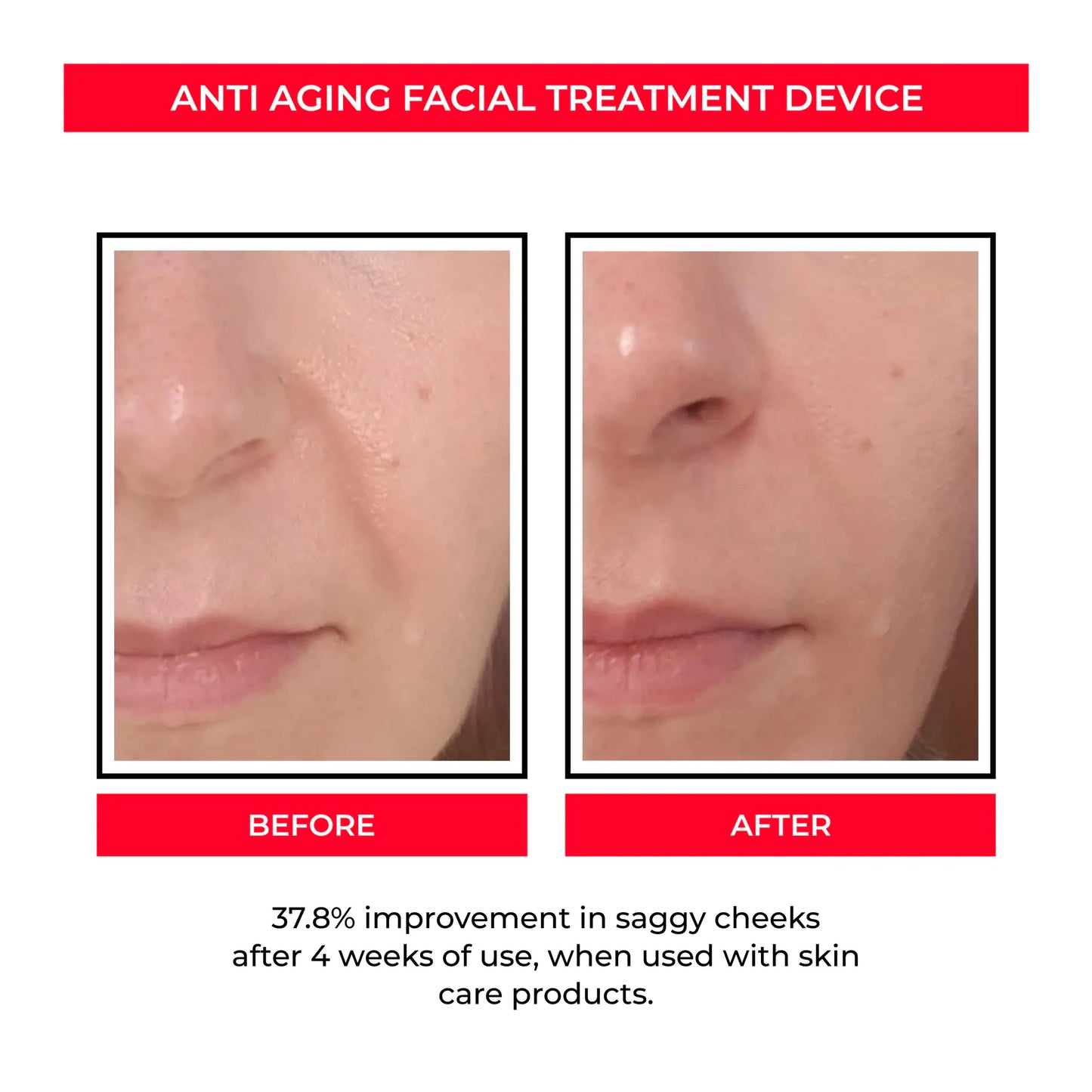New Beauty Device for Pore Tightening - EMS Blue Light
